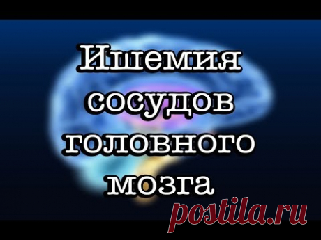 Ишемия головного мозга: что это такое, симптомы и лечение
