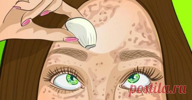 4 средства для отличной кожи. Убирают пигментные пятна как ластик | З Д О Р О В | Яндекс Дзен