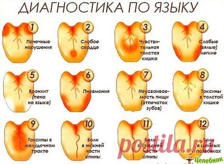 Диагностика  по языку