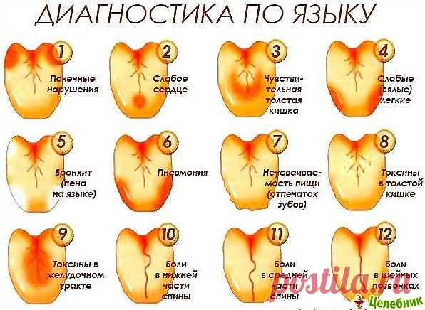Диагностика по языку и др.