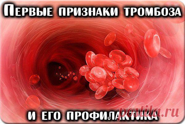 ПЕРВЫЕ ПРИЗНАКИ ТРОМБОЗА И ЕГО ПРОФИЛАКТИКА.