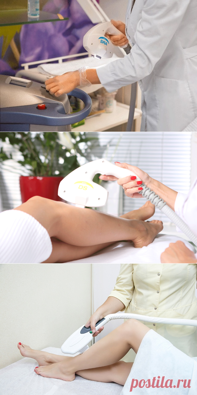 Элос-эпиляция ног: что это такое, противопоказания и последствия