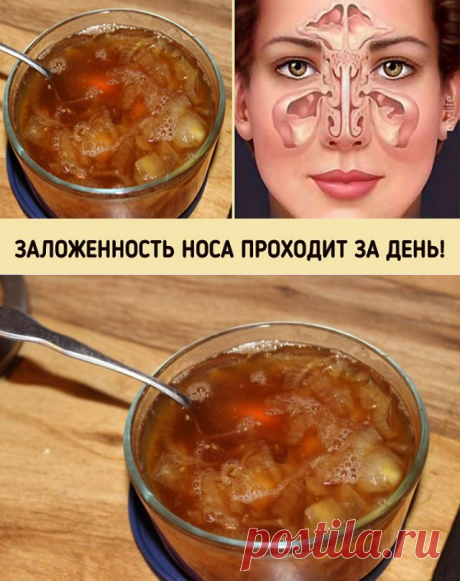 Супер-средство от заложенного носа. Будете свободно дышать уже на утро!
