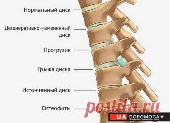 Остеохондроз, заболевания суставов и современные способы их лечения.