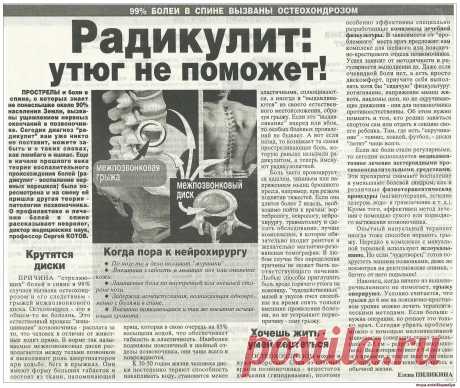Радикулит
