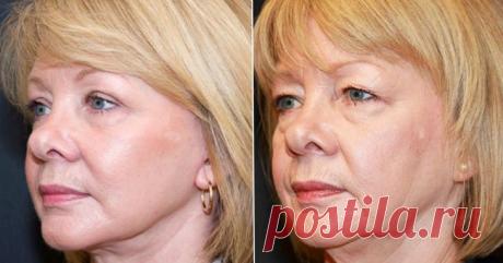 Этого вы точно не знали! Простое и гениальное средство для сохранения молодости – В РИТМІ ЖИТТЯ