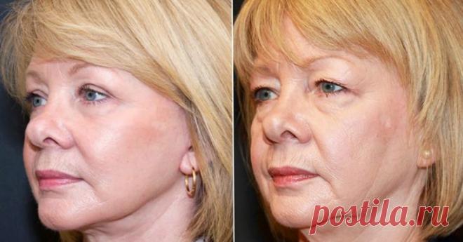 Этого вы точно не знали! Простое и гениальное средство для сохранения молодости – В РИТМІ ЖИТТЯ