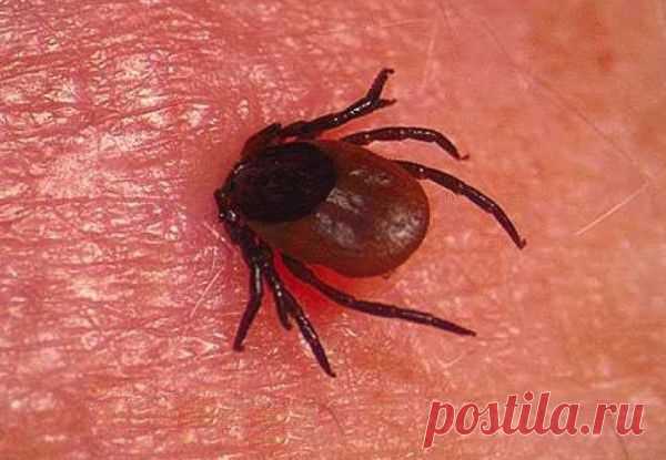 Постельные клопы являются переносчиками инфекций | Новости здоровья - здоровый образ жизни