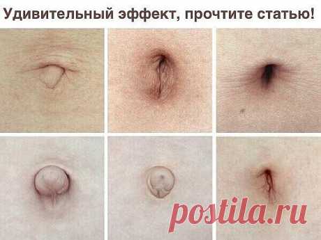Вы знали, зачем смазывать пупок маслом?

В моей практике был один запоминающийся случай, после которого, я аспирант тогдашнего Ленинградского мединститута, стал собирать всю информацию и печатную, и устную, от других коллег и своих пациентов, об этом важном отделе нашего тела "Пупке".
У 62-летнего мужчины (обратившегося ко мне с проблемами суставов) также было и плохое зрение, особенно, на левый глаз, он плохо видел, особенно при искусственном освещении, после заката солнц...