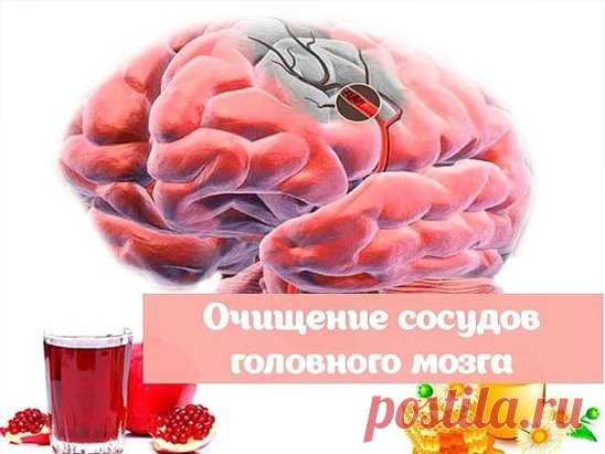 ОЧИЩЕНИЕ СОСУДОВ ГОЛОВНОГО МОЗГА.