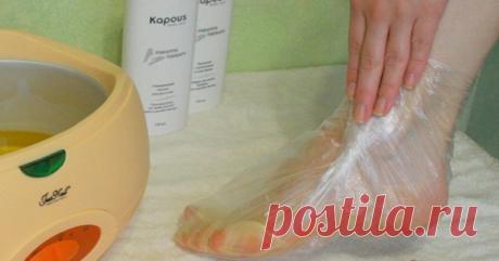 Косточка на ступне