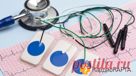 Методы диагностики в кардиологии. Когда и кому они нужны? | КардиоКАРТА | Кардиология | Дзен