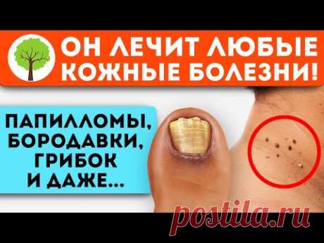Только ТАК эта трава сотрет грибок, папилломы, бородавки и даже... Народная медицина