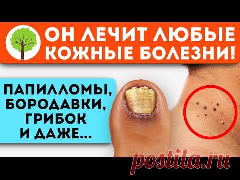 Только ТАК эта трава сотрет грибок, папилломы, бородавки и даже... Народная медицина