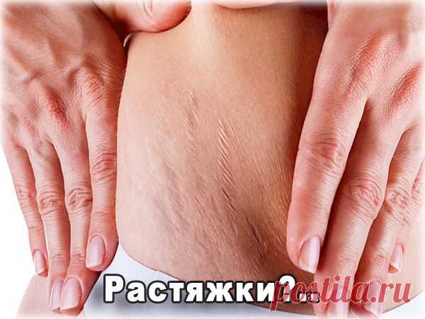 Растяжки на коже. Причины появления, методы эффективной борьбы и профилактики.