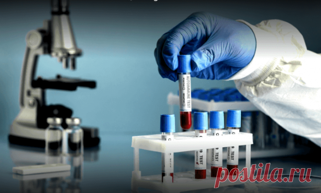 The autoimmune disease testing market size was USD 4.84 billion in 2021 and is projected to grow from USD 5.52 billion in 2022 to USD 10.75 billion by 2029, exhibiting a CAGR of 10.0%.
