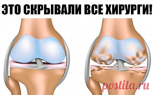 Это скрывали все хирурги! Так лечатся суставы дома за сутки
Эта микстура «скорая помощь» от боли в суставах.

Такая микстура должна быть в каждом доме. Ингредиенты: 1 сл. ложка крупной соли, 1 литр воды, нашатырный спирт, камфорное масло. Всыпьте 1 ст. ложку соли крупного помола в 1 л воды и размешайте. Отдельно возьмите 80-100 мл 10 %-го нашатырного спирта и влейте туда 10 г камфорного спирта. Смесь взболтайте и соедините с солевым раствором. Появятся белые хлопья. Закрой...