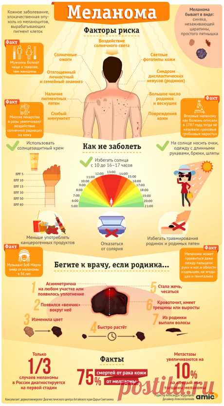 Кто и как может заболеть смертельным кожным раком - меланомой