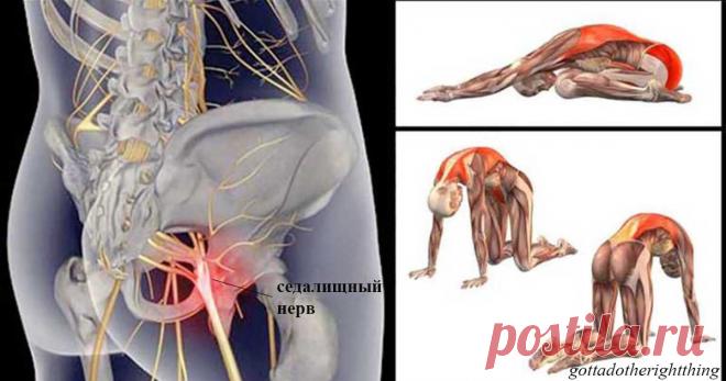 11 упражнений, которые избавят вас от боли в спине , когда воспалился седалищный нерв Воспаление седалищного нерва (ишиас) может возникнуть даже у людей, которые считают себя абсолютно здоровыми. Этот нерв является наиболее длинным в нашем организме. Он затрагивает не только поясницу, но и копчик, заднюю поверхность таза, обе ноги.