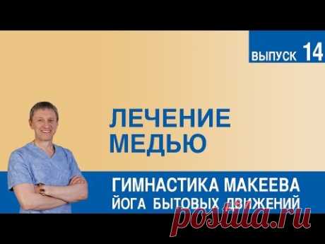 Лечение медью - YouTube