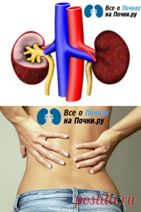 Почки.ру: все о заболеваниях почек и их лечении