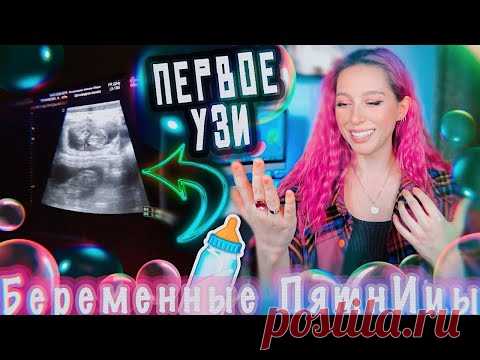 Наше ПЕРВОЕ УЗИ!!! / Концерт BTS #ВеселыеПятнИцы