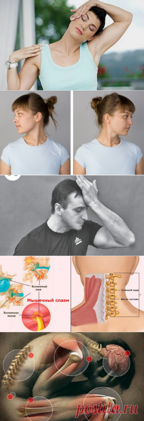 Мышечные зажимы шеи и спины: избавилась раз и навсегда! — Копилочка полезных советов