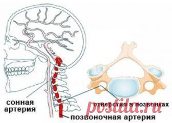 Гипертония при синдроме шейных артерий. Лечение | Советы целительницы
