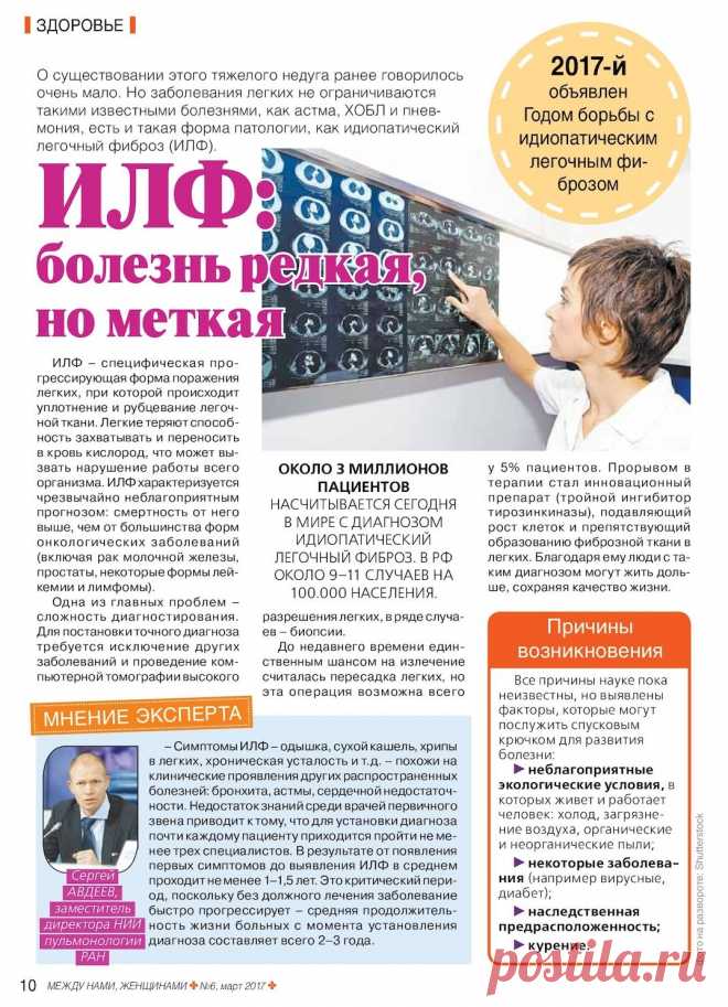 Идиопатический легочный фиброз (ИЛФ)