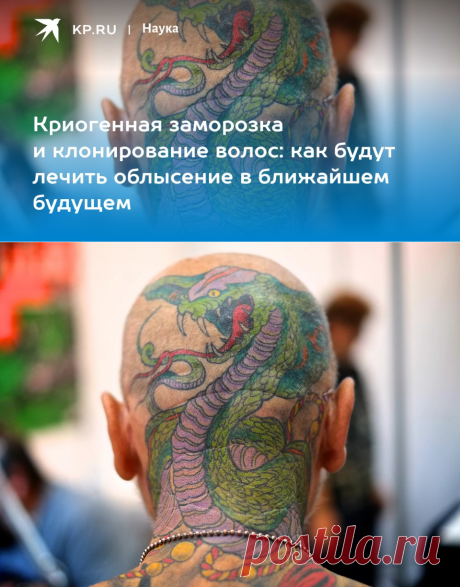 Криогенная заморозка и клонирование волос: как будут лечить облысение в ближайшем будущем - KP.RU