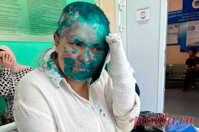 Омбудсмен рассказал о состоянии избитых в Чечне Милашиной и Немова. Решение о переводе госпитализированных после избиения в Чечне журналистки Елены Милашиной и адвоката Александр Немова в больницу Москвы из Беслана будет позже принято осетинскими врачами, сообщил РБК уполномоченный по правам человека Северной Осетии Тамерлан Цгоев.