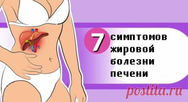 Жирная печень – нефункционирующая должным образом печень. Чтобы избавиться от этого заболевания необходимо правильно питаться. Тяжелое потребление алкоголя является одним из основных факторов риска, когда речь идет о проблемах с печенью, таких как алкогольная болезнь печени. Но даже люди, которые не любят алкоголь, рискуют заразиться неалкогольной жировой болезнью печени. 7 симптомов жировой болезни печени Боль […]