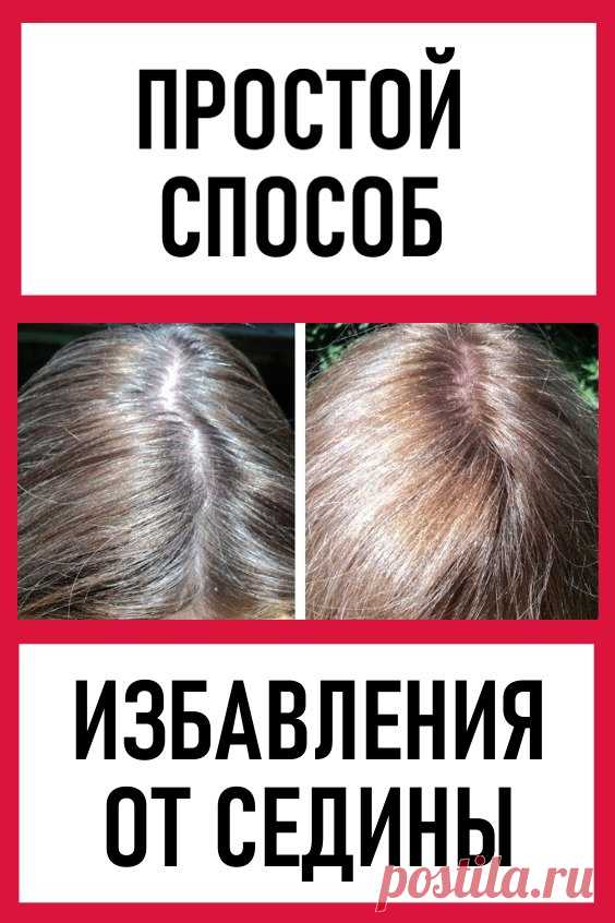 Простой способ избавления от седины. Если вид собственных седых волос вас удручает, а от постоянного подкрашивания вы и ваши волосы уже устали, прочтите внимательно наш рецепт.
