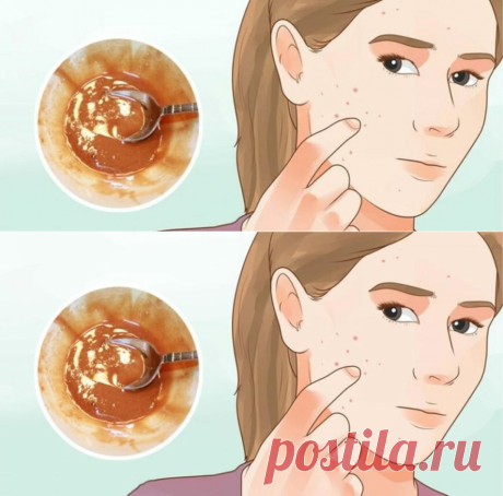 Эта маска для лица естественно удаляет пятна, шрамы от угревой сыпи и морщины после второго использования - Советы для тебя - Полезные советы
Просматривайте этот и другие пины на доске Красота пользователя Irina.
Теги
Эта маска для лица действительно удаляет пятна и шрамы от угрей и морщин после первого применения
Что говорят другие
Красивая попа.
5 эффективных упражнений