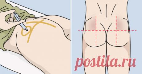 Как правильно делать укол | Путь к здоровью | Яндекс Дзен