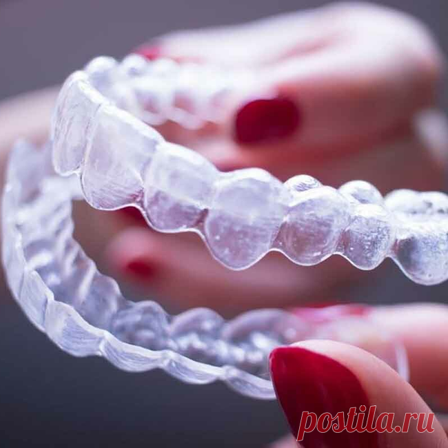 2023-Элайнеры: invisalign, star smile, flexiligner, 3D smile - Палома Бланка (Paloma Blanca) - Стоматологическая клиника