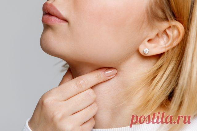 Чем чреваты тонзиллитные камни Тонзиллит — слово, знакомое многим и обозначающее привычную ангину. Однако, кроме воспаления, в миндалине могут образовываться и «камни». Их так и называют — тонзиллитные камни. Что же собой представляют образования и к чему они могут привести?