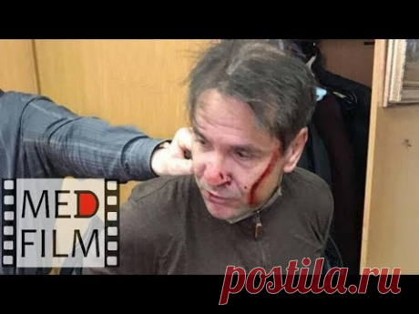 Шизофрения. С ножом на журналистку. Бред преследования © Paranoid schizophrenia