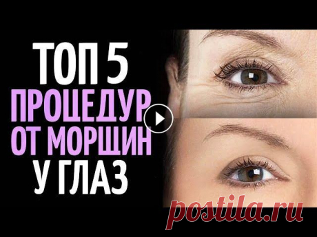 Как избавиться от морщин вокруг глаз? ТОП 5 процедур. Друзья, в этом ролике я расскажу о 5 самых эффективных процедурах, которые помогут избавиться от морщин под глазами. В видео пойдет речь о следующих п...