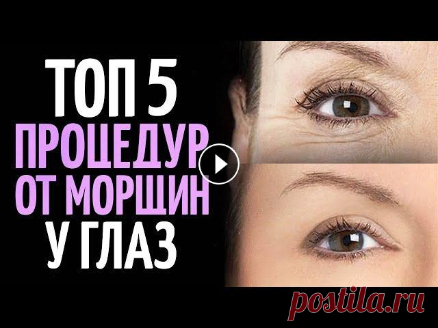 Как избавиться от морщин вокруг глаз? ТОП 5 процедур. Друзья, в этом ролике я расскажу о 5 самых эффективных процедурах, которые помогут избавиться от морщин под глазами. В видео пойдет речь о следующих п...