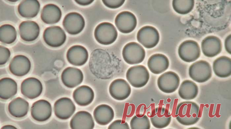 Дабы «иммунка» ожила на 100%, требуется всего лишь выдержка и 3 дня