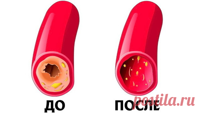 Чистим сосуды и кровь: рецепт 7 стаканов

ПОДПИШИСЬ И ЧИТАЙ ПРОДОЛЖЕНИЕ
Кардиологи ошарашены! Гипертония лечится мгновенно! Простой, бабушкин метод, нужно…

Сегодня я хотела вам написать рецепт 7 стаканов. Я давно о нем слышала, слышала положительные отзывы.

А недавно папа позвонил, попросил найти для него народное средство, чтоб кровь почистить и сосуды.

Последнее время у него участились головные боли. Я сразу вспомнила об этом рецепте. Я его конечно на себе не испытыва...