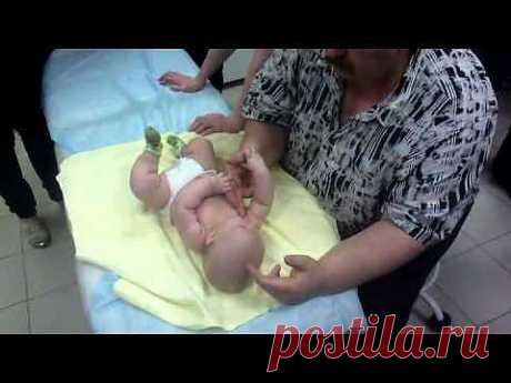 Лечение кривошеи. | Советы доктора