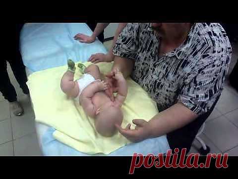 Лечение кривошеи. | Советы доктора