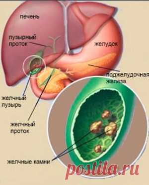 Травы и чаи для лечения и очищения нашей печени.
