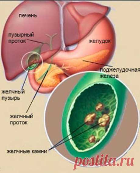 Травы и чаи для лечения и очищения нашей печени.