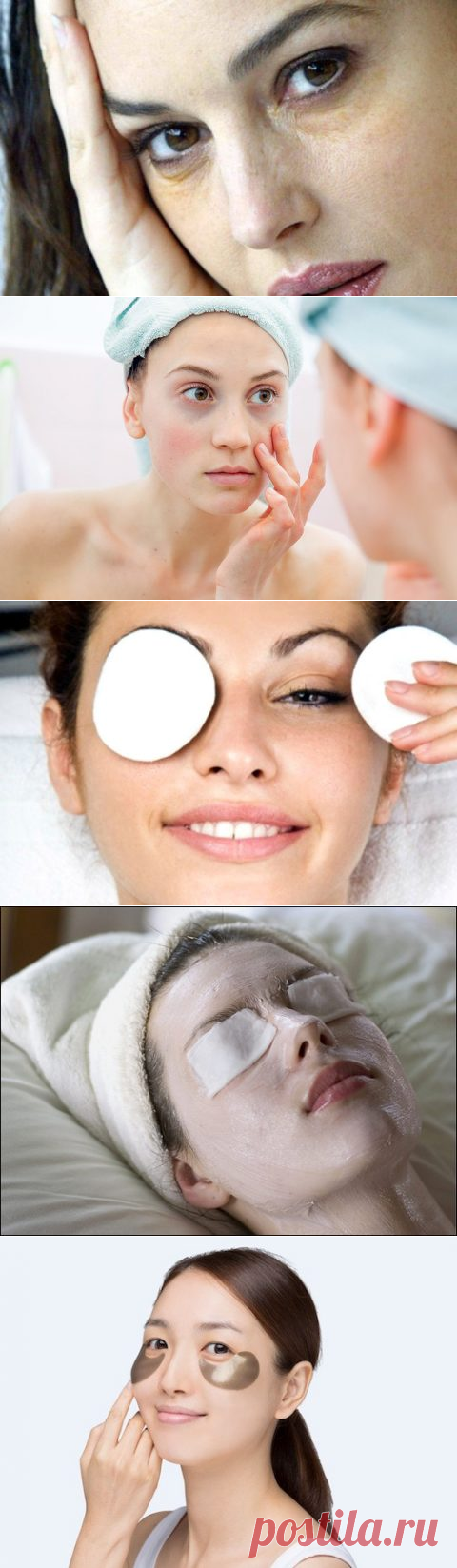 Как избавиться от синяков под глазами в домашних условиях