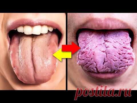 3 вещи, Которые Ваш ЯЗЫК ПЫТАЕТСЯ РАССКАЗАТЬ о Вашем Здоровье...