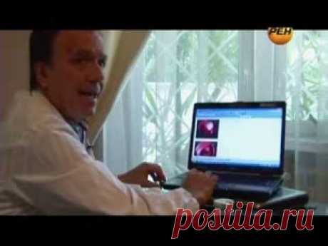 Как можно уменьшить рак 4 стадии на треть за один день