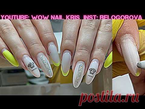 Хочу КАЛЯ-МАЛЯ Голубенькое! Как бороться с отслойками??